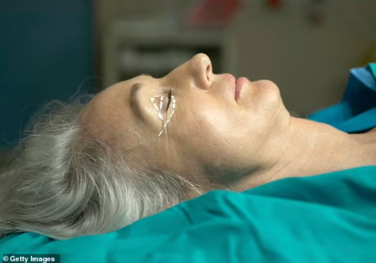 Over the years, eyelid surgery has been perfected